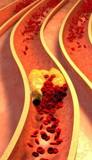 What happens inside your body when blood sugar spikes
